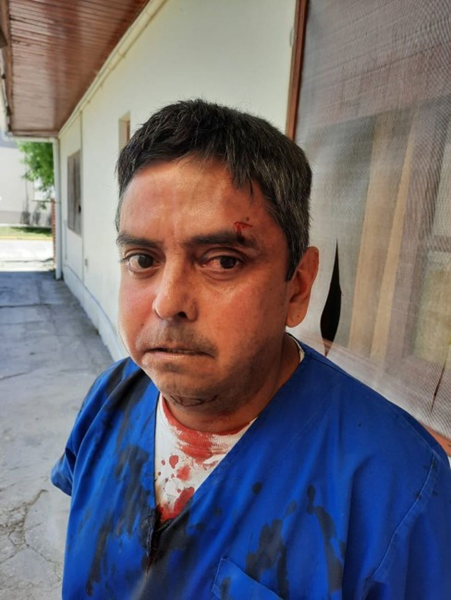 Así quedó el rostro del secretario de Salud de General Lavalle tras la agresión
