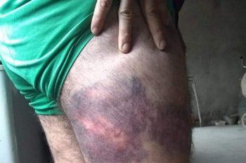 lincoln: denuncian a policias por torturar y abusar sexualmente de varios jovenes
