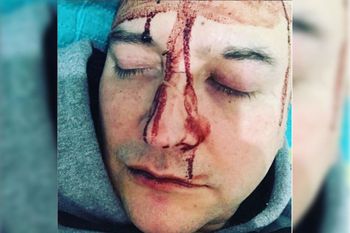 Leo García relató cómo fue el ataque en sus redes sociales