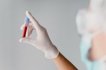 Realizan testeos gratuitos de HIV y sífilis en La Costa: ¿dónde y cuándo realizarlos?