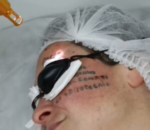 Candidata libertaria de Esteban Echeverría borra sus tatuajes para no parecer “feminista” por accidente