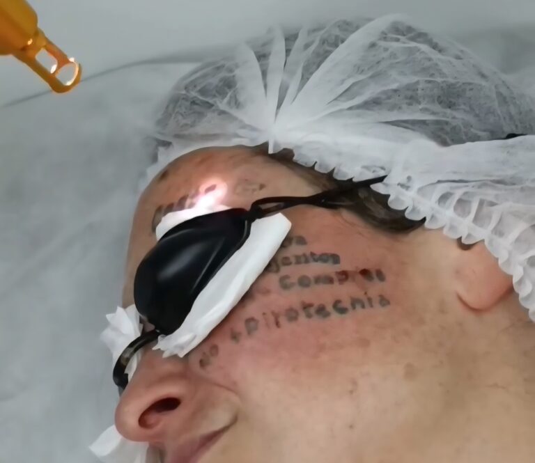 Candidata libertaria de Esteban Echeverría borra sus tatuajes para no parecer “feminista” por accidente